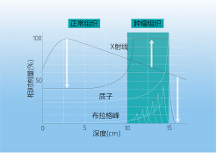 質(zhì)子治療兒童腫瘤一文詳解！